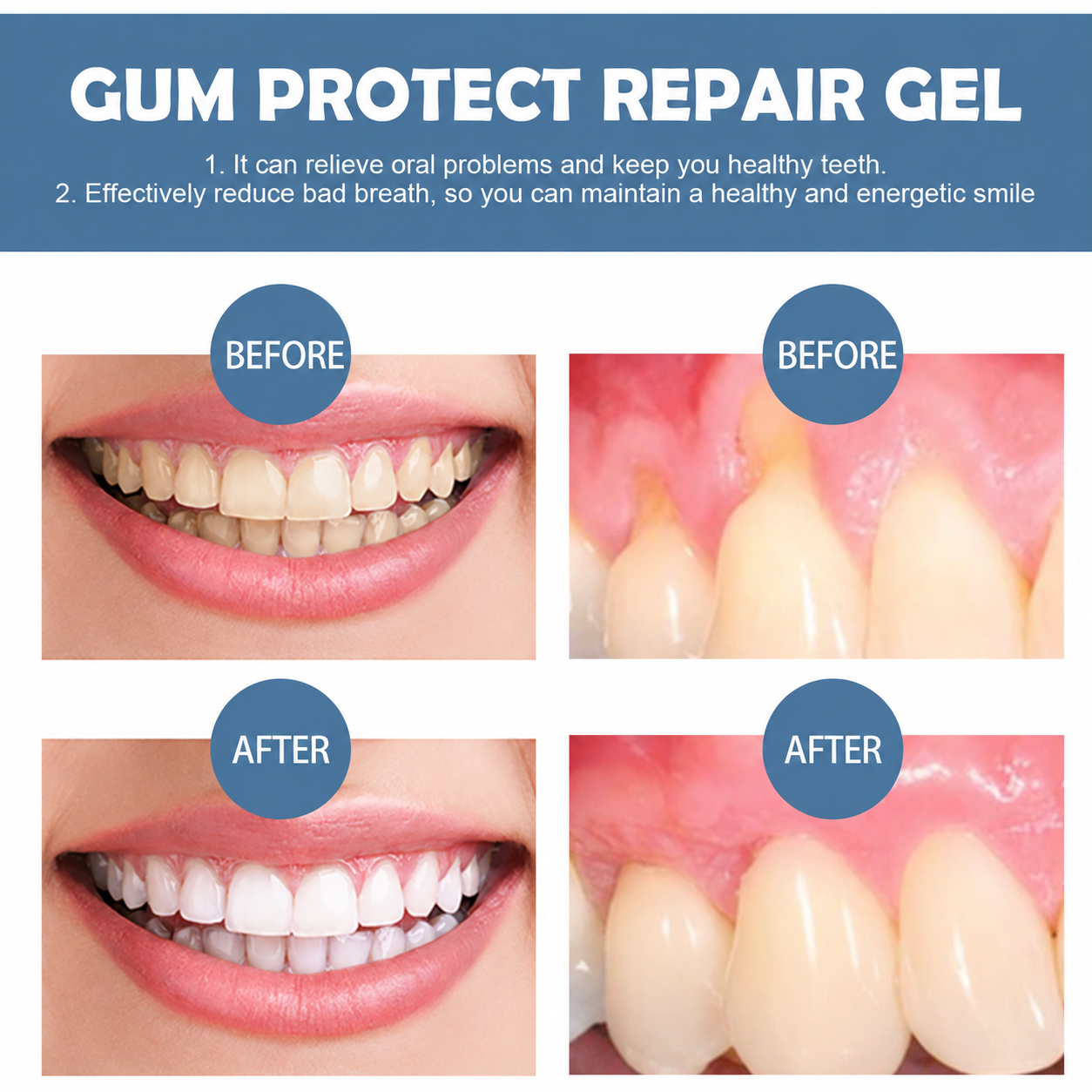 Mycariva™ Teeth Repair Gel revitalizes gums and whitens teeth within the first week