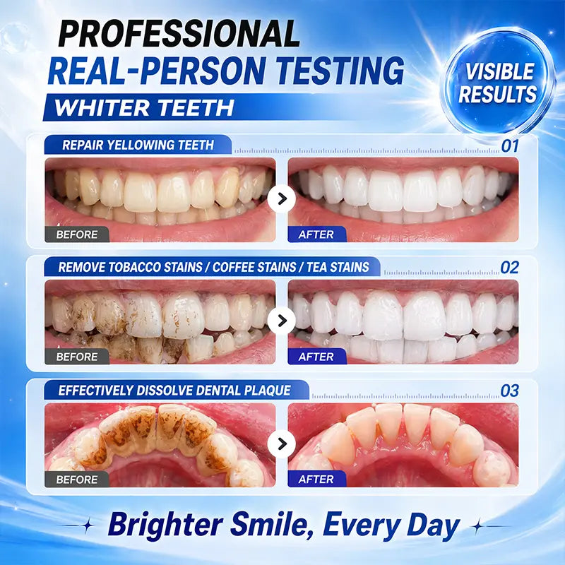 [Professional Grade] Niacinamide Foaming Toothpaste 8X