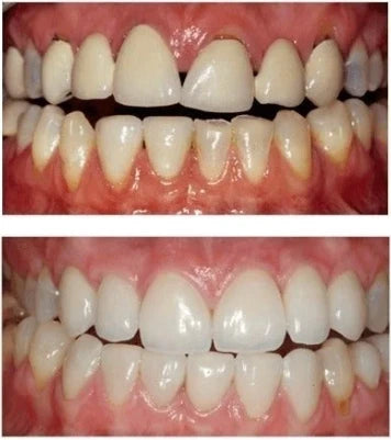 Customer smile before and after comparison